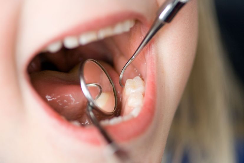 Getting Dentures In Kona Can Solve Your Smiling Challenges