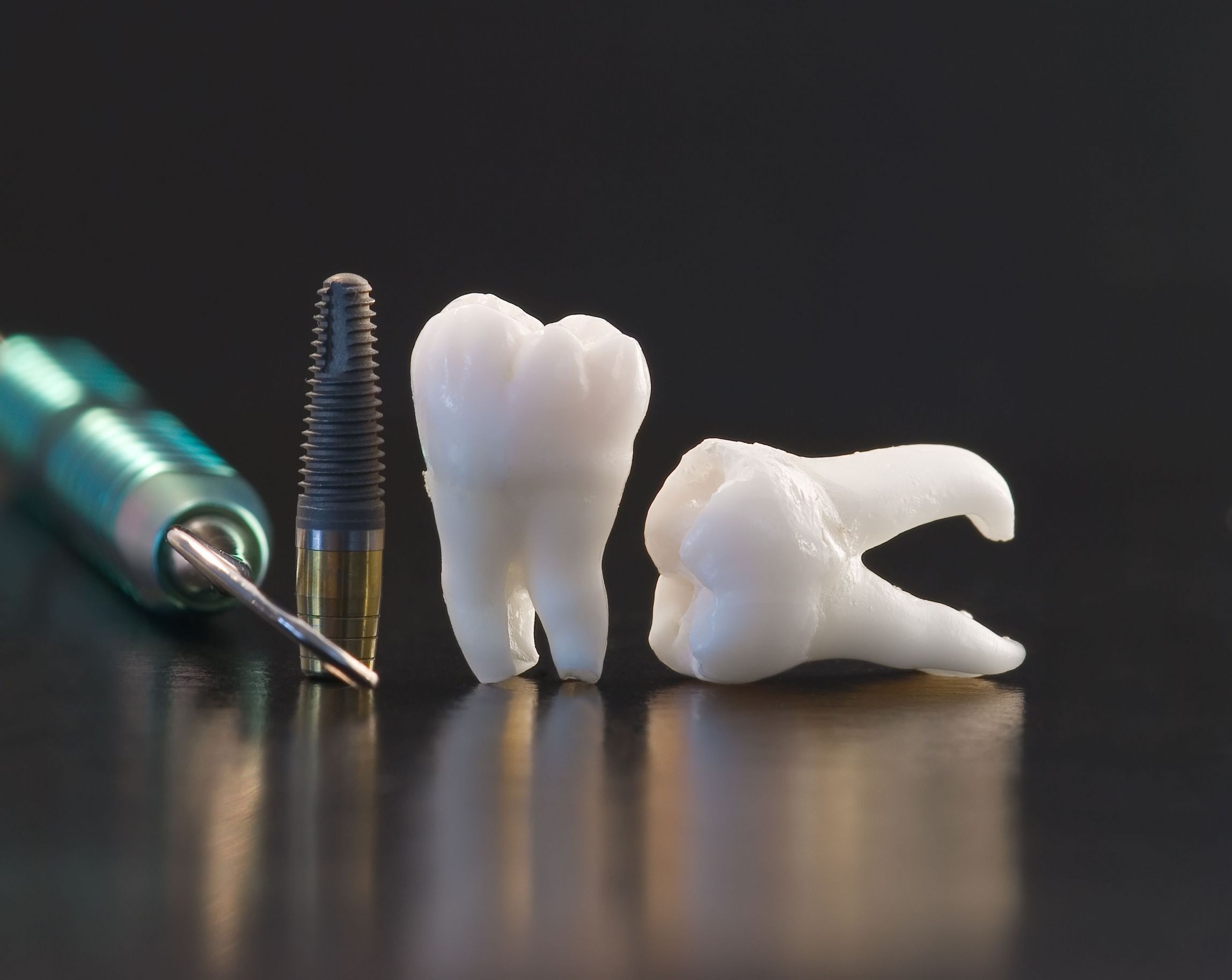 Implant Dentures in Phoenix Are an Option Everyone Should Consider