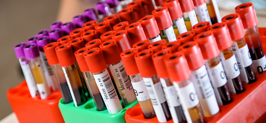 Health Problems that can be Detected through Blood Testing