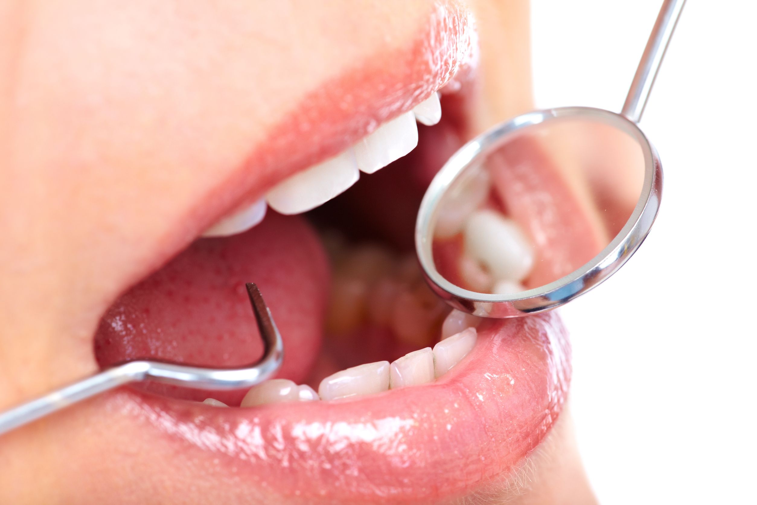 How to Choose the Perfect Dentist for You