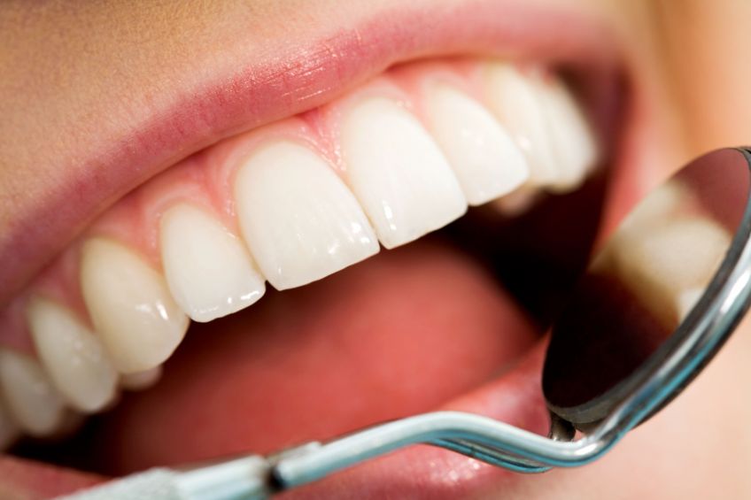 Dental Veneers in Chicago can Painlessly Improve Your Smile