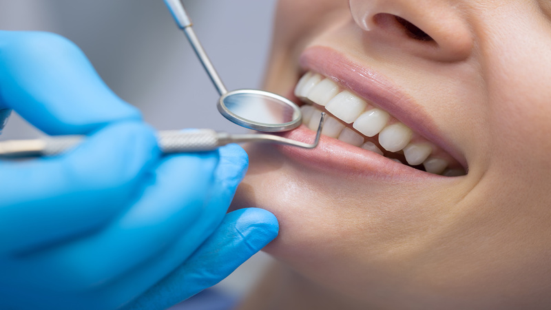 Benefits of Regular Dental Care in Laurel MS