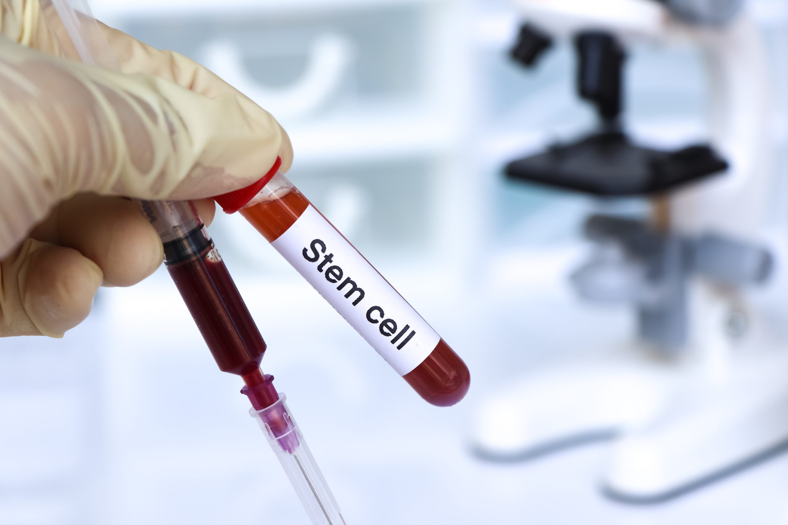 The Potential of Stem Cell Therapy in Los Angeles