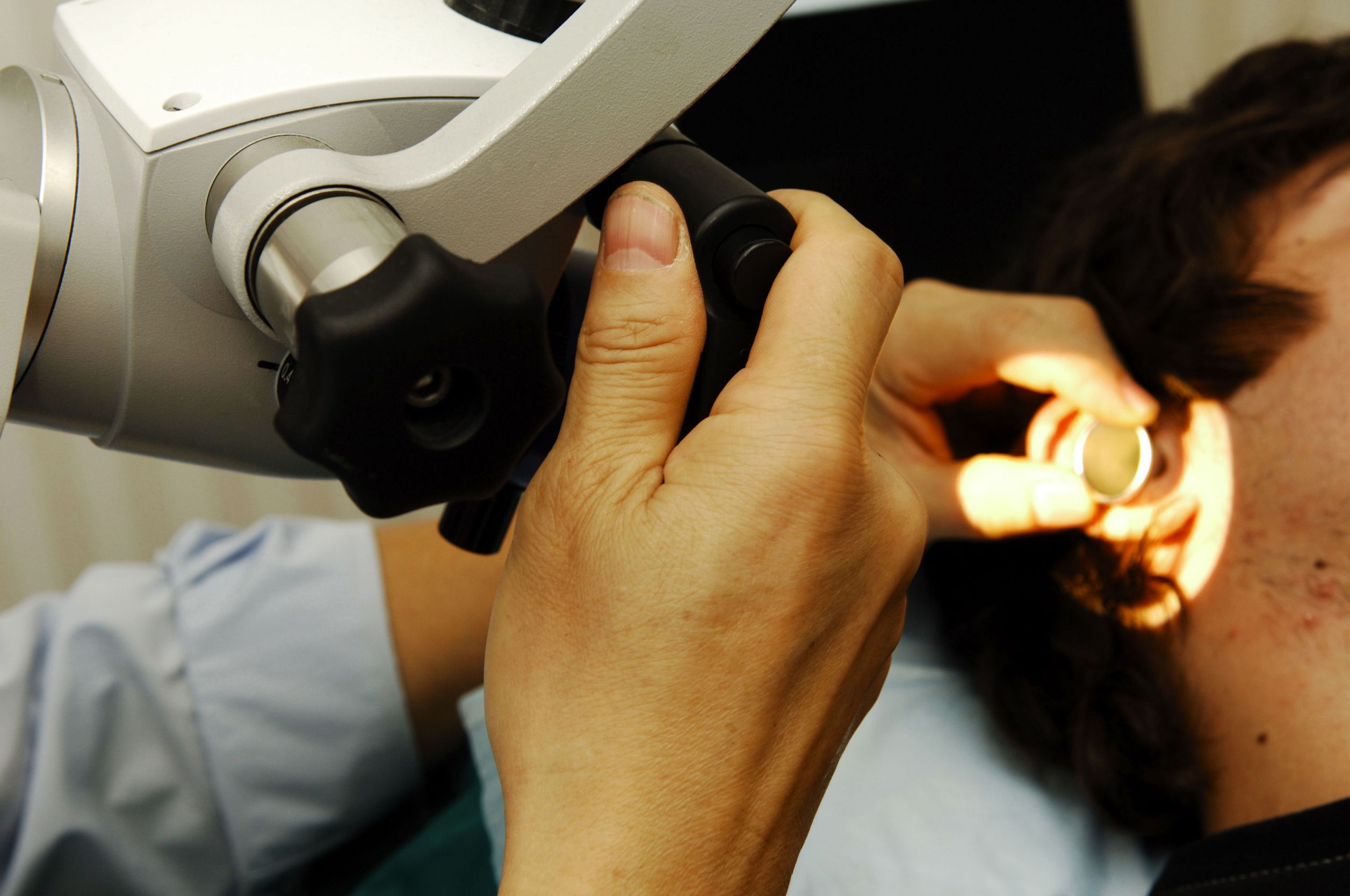 What Patients Need to Know About Ear Lobe Surgery in Tampa, FL