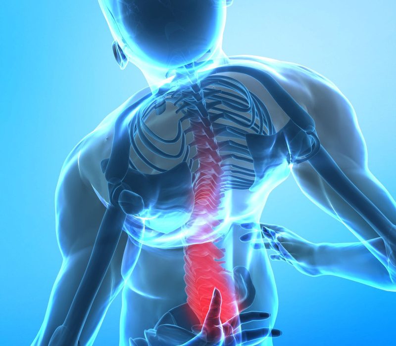 What to Expect When Visiting a Chiropractor for Sciatica Near Gresham, OR?